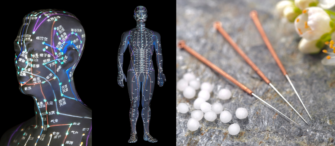 Classical Acupuncture